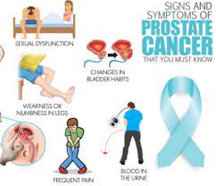 The symptoms and signs of prostate cancer may include: Prostate Cancer Overview Causes Early Symptoms Treatment