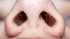 Removing the hair can potentially lead to a less physiological mechanism of the nose. You Should Never Pluck Your Nose Hair Here S Why
