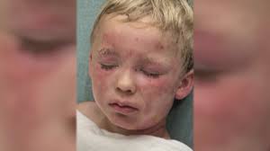 Southern Oklahoma Ambulance Service and community honor fallen heroes with  bridge dedication