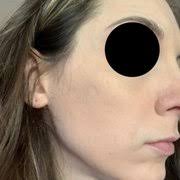 FRONTIER DERMATOLOGY