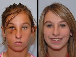 Facial Reconstruction Surgery In Dubai Abu Dhabi Dubai Cosmetic Surgery Plastic Surgery Reconstructive Surgery Types Of Plastic Surgery