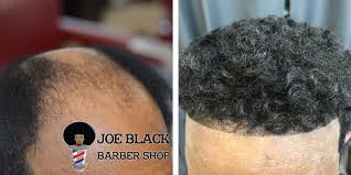 Men's services include clipper cuts and shaves with a razor blade. Men S Hair Replacement Services In Houston Tx Joe Black Barbershop