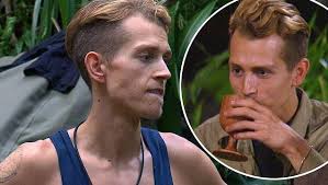 James Mcvey S Band Are Worried About His Weight Loss On I M A Celeb Popular Indi News