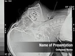 500 Ct Scan Powerpoint Templates Powerpoint Backgrounds For Ct Scan Presentation