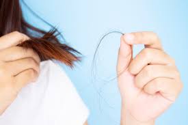 Hair loss during pregnancy can be due to vitamin and mineral deficiencies in our body. Hair Loss In Pregnancy Doctor 4 U