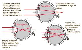 Common Eye Defects