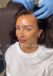 Replying to @anonymous come get Prp hair injections with me @Dr David Jack