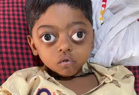 Dr Nihar Gupta Hematologist & Hemato-oncologist Mittal Hospital Raipur