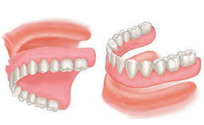 Bursa Diş Protezi - Bursa Dental Klinik -