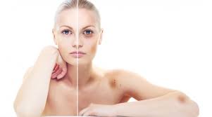 To make bruise marks go away fast, try the following natural home remedies and treatments. How To Get Rid Of A Bruise Fast And Easily On Face Legs At Home Naturally