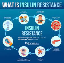 Learn about a treatment option that may be able to reduce total insulin injections. Insulin Resistance 10 Ways To Stabilize Blood Sugar Drjockers Com