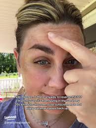 Achieve the Perfect Summer Glow with Self-Tanning Mousse