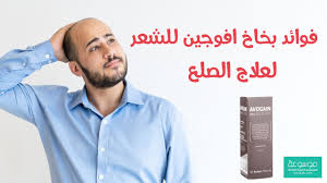 معلومات عن بخاخ افوجين مينوكسيديل لعلاج تساقط الشعر مجرب وطريقة استخدامه Youtube