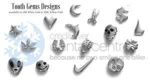 How much does tooth jewellery cost? Tooth Jewlery Toronto Credit River Dental Centre