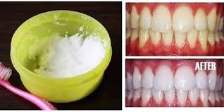 Check spelling or type a new query. Tips Dan Fakta Putihkan Gigi Anda Dalam Masa 3 Minit Sahaja Ikuti Cara Ini Tanpa Produk Magik Pena