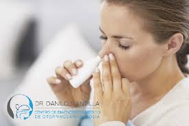 Cirugía Endoscópica para Pólipos Nasales