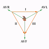 Electrocardiogram Leads