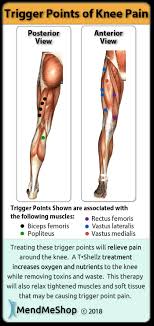 Knee Pain Trigger Point Chart