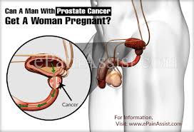 But one attribute in him can irritate you is his possessive nature. Can A Man With Prostate Cancer Get A Woman Pregnant