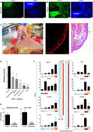 In normal tissues d2‐40 is also expressed in mesothelium and fetal testes. Surgical Adhesions In Mice Are Derived From Mesothelial Cells And Can Be Targeted By Antibodies Against Mesothelial Markers Science Translational Medicine