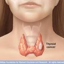 If these begin to rise, imaging tests such as an ultrasound of the neck or a ct or mri scan will be done to look for any cancer coming back. Thyroid Cancer On Twitter Do U Know Goiter Symptoms In Women Http T Co 9foko2qm