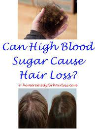 This is because dht can damage hair follicles until they stop producing. Nizoral Shampoo Stop Hair Loss Can T Sleep Hair Loss Kerastase Hair Loss Tablets Famous Celebrities With H Vitamins For Hair Loss Hair Loss Shampoo Hair Loss
