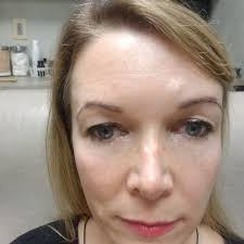 TOP 10 BEST Oculoplastic Surgeon in Carmel, IN