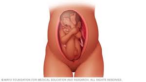 Slide Show Fetal Presentation Before Birth Mayo Clinic