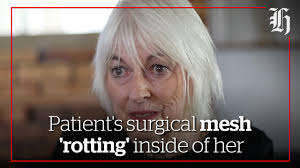 In Her Head women's health: Sally Walker's surgical mesh trauma