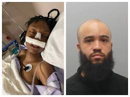 15-year-old McDonald's worker suffers skull fracture after being attacked  by upset customer