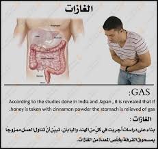 صحتك القرفة والعسل شركات الأدوي ة لا تحب ذ إشاعة الخبر Health Fitness Nutrition Health Check Health And Nutrition