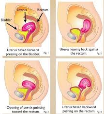 Pin On Uterus