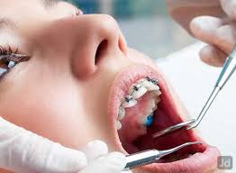 Perfect smile dental care dehradun city dentists in dehradun. 100 Best Teeth Implants In Dehradun Uttarakhand Nearmetrade