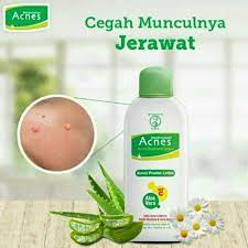 Acnes Powder Lotion 100 Ml Shopee Singapore