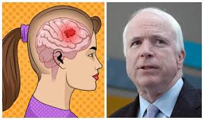 Mental disorders drugs disorders that mainly affect the brain bodywide disorders that also affect the brain. 7 Early Warning Signs Of Brain Cancer That You Need To Know