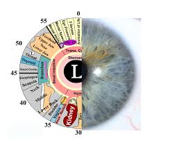 Iridology Assessments Gold Coast For Weight Loss