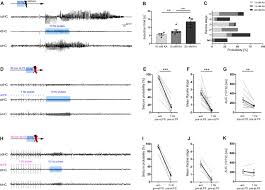 Users can use the apps to prank their friends and family. Hippocampal Low Frequency Stimulation Prevents Seizure Generation In A Mouse Model Of Mesial Temporal Lobe Epilepsy Elife