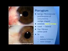 Pin By Kutryb Eye On Wellness Eye Health Helpful Hints Health And Beauty