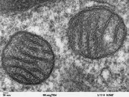 Why does an animal cell have a mitochondria? Mitochondrion Wikipedia