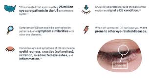 Image result for demodex rosacea