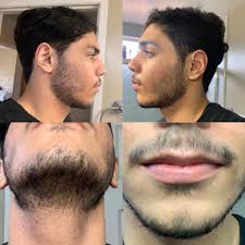 That's the male sex hormone. 24 Days Growth Decided To Grow My Facial Hair How Much More Will I Have To Wait Until It S Full And Do You Guys Have Any Suggestions About Wether I Should Start