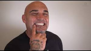 Jose Luis Capote. Rehabilitación oral: Implantes y Carillas Dentales