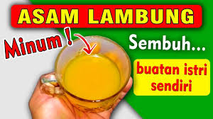 Mengobati asam lambung penting agar puasa di bulan ramadan bisa berjalan dengan lancar. Obat Asam Lambung Buatan Istri Cara Mengobati Asam Lambung Naik Secara Kunyit Obat Alami Resep Sehat