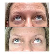 Vanessa Cichon, ACNPC-AG, FNP