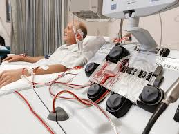 Image result for Apheresis