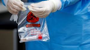 Последняя информация о коронавирусе на сайте минздрава. China Usa Teste Anal Com Cotonete Para Detectar Covid 19 Cotidiano Acidade On Sao Carlos