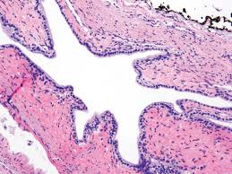 A 2020 report on online training uncovered that, of online lone wolf&#x27;s projects, 57% are completely on the web, instead of half and half. Unusual And Metastatic Lesions Thoracic Key