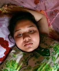 মাত্র ৫ মিনিট এ দাগ ছপ ব্রন দুর করে চকচকে সা*দা গ্লাস স্কিন করে দেখাবো 😱