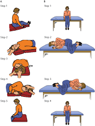 Image result for Canalith Repositioning Procedure