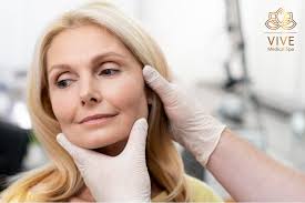 PDO Thread Lift: How to Maintain Results